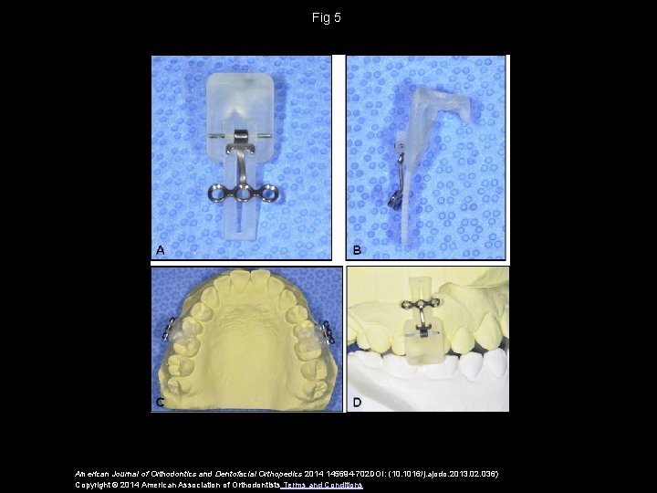 Fig 5 American Journal of Orthodontics and Dentofacial Orthopedics 2014 145694 -702 DOI: (10.