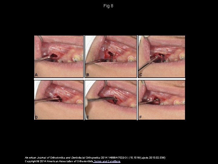 Fig 8 American Journal of Orthodontics and Dentofacial Orthopedics 2014 145694 -702 DOI: (10.