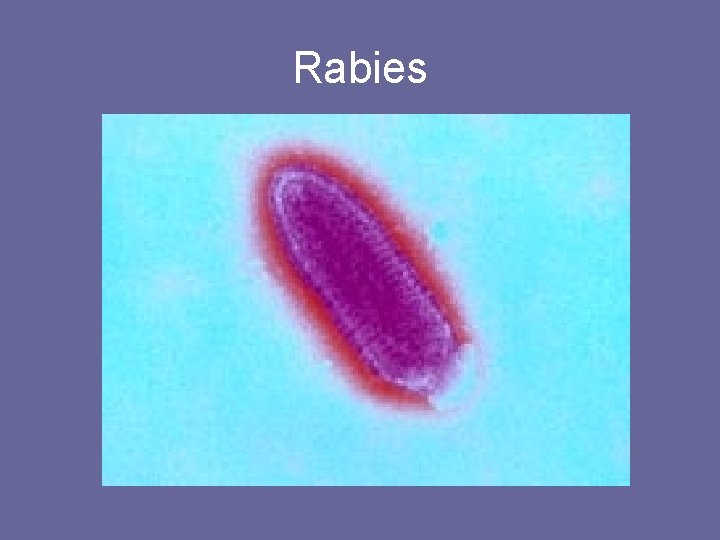 Rabies 