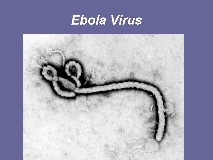 Ebola Virus 