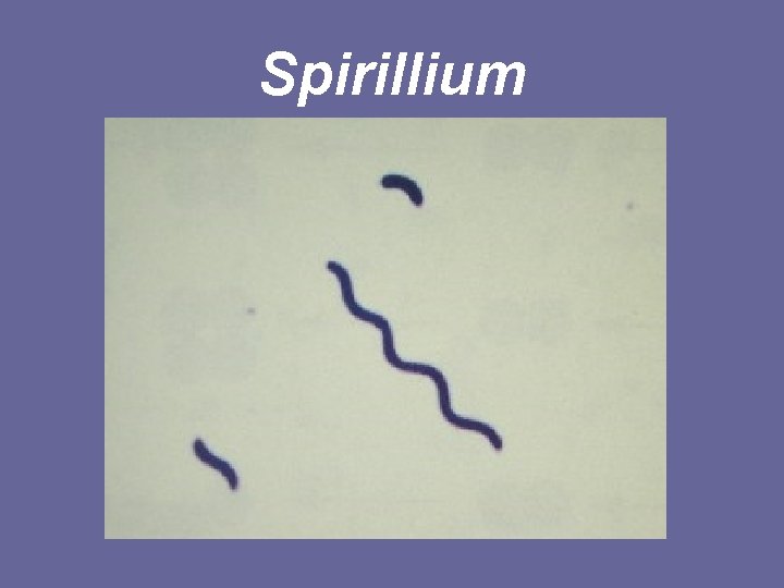 Spirillium 