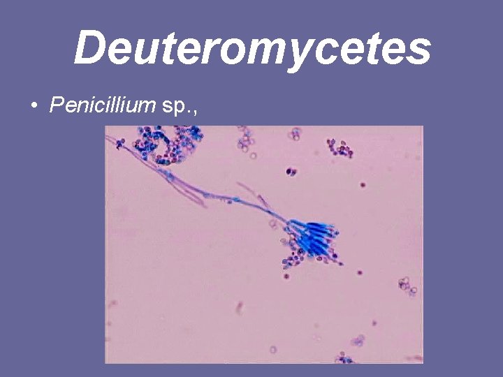 Deuteromycetes • Penicillium sp. , 