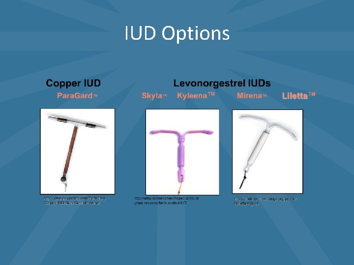 IUD Options IUD Options