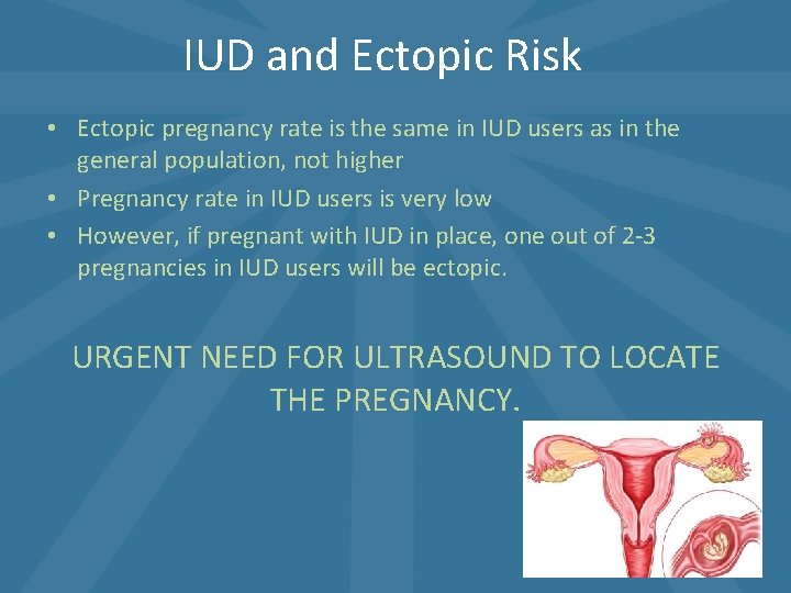 IUD and Ectopic Risk • Ectopic pregnancy rate is the same in IUD users IUD and Ectopic Risk • Ectopic pregnancy rate is the same in IUD users