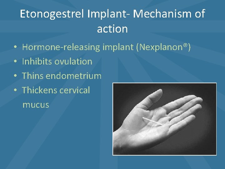Etonogestrel Implant- Mechanism of action • • Hormone-releasing implant (Nexplanon®) Inhibits ovulation Thins endometrium Etonogestrel Implant- Mechanism of action • • Hormone-releasing implant (Nexplanon®) Inhibits ovulation Thins endometrium