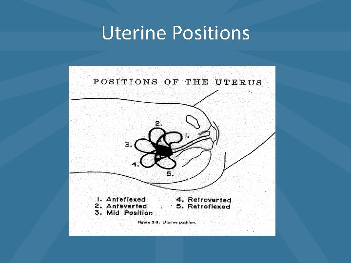 Uterine Positions Uterine Positions