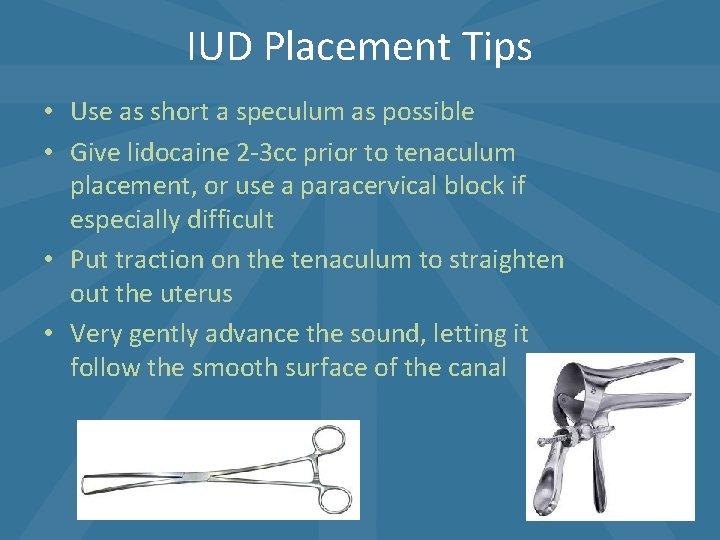 IUD Placement Tips • Use as short a speculum as possible • Give lidocaine IUD Placement Tips • Use as short a speculum as possible • Give lidocaine