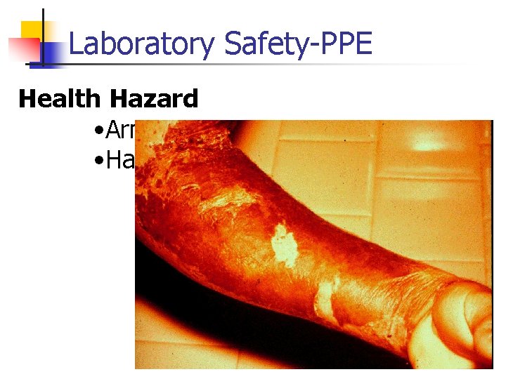 Laboratory Safety-PPE Health Hazard • Arms • Hands 