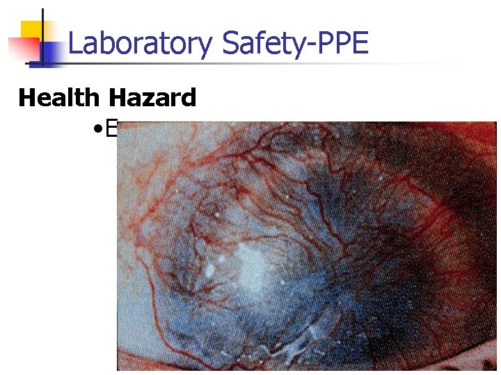 Laboratory Safety-PPE Health Hazard • Eyes 