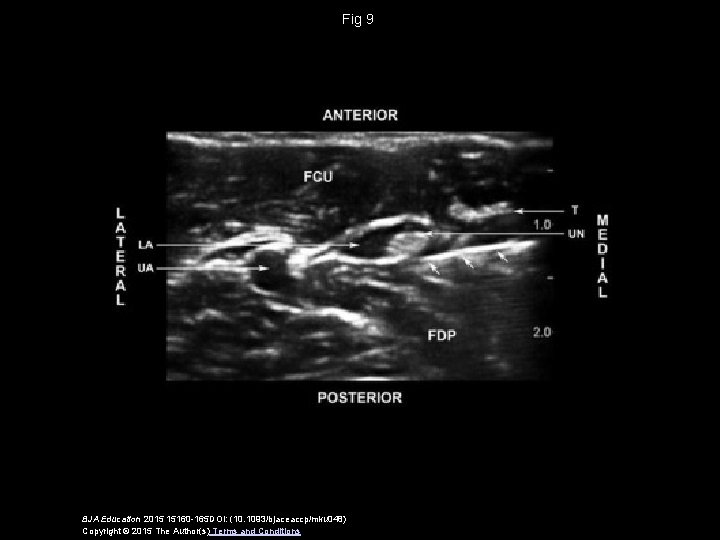 Fig 9 BJA Education 2015 15160 -165 DOI: (10. 1093/bjaceaccp/mku 048) Copyright © 2015