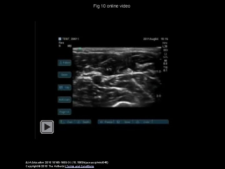 Fig 10 online video BJA Education 2015 15160 -165 DOI: (10. 1093/bjaceaccp/mku 048) Copyright