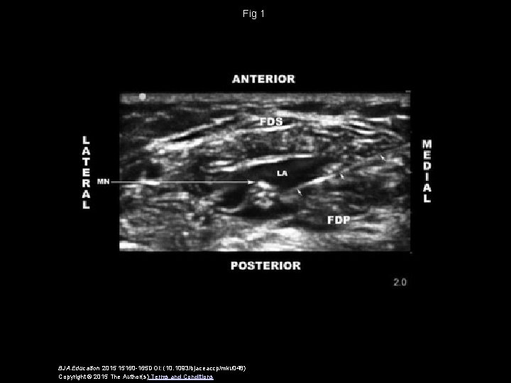 Fig 1 BJA Education 2015 15160 -165 DOI: (10. 1093/bjaceaccp/mku 048) Copyright © 2015