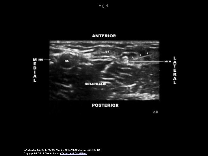 Fig 4 BJA Education 2015 15160 -165 DOI: (10. 1093/bjaceaccp/mku 048) Copyright © 2015