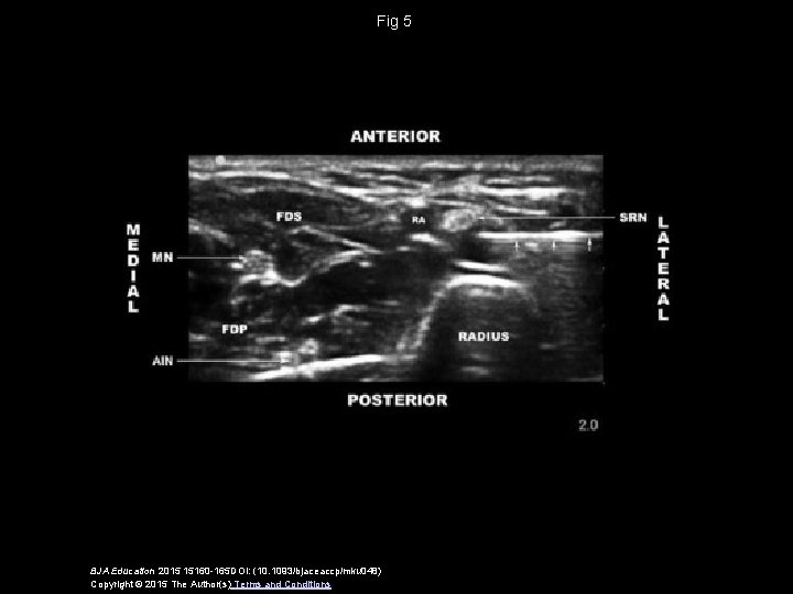Fig 5 BJA Education 2015 15160 -165 DOI: (10. 1093/bjaceaccp/mku 048) Copyright © 2015