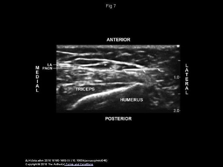 Fig 7 BJA Education 2015 15160 -165 DOI: (10. 1093/bjaceaccp/mku 048) Copyright © 2015