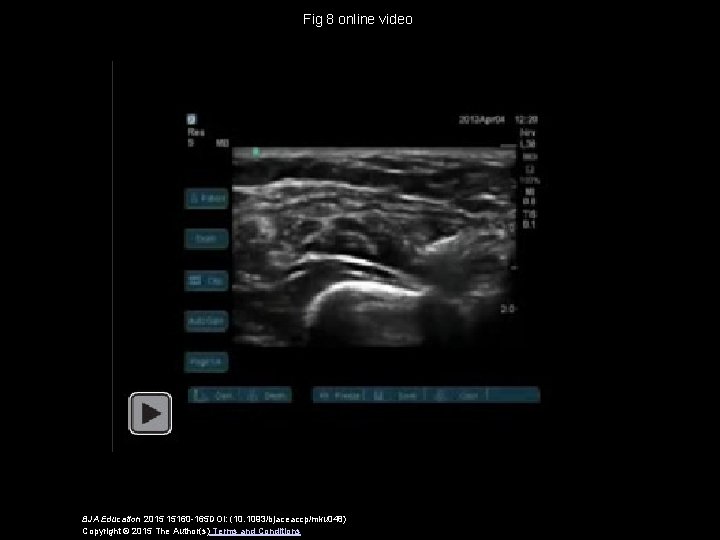 Fig 8 online video BJA Education 2015 15160 -165 DOI: (10. 1093/bjaceaccp/mku 048) Copyright