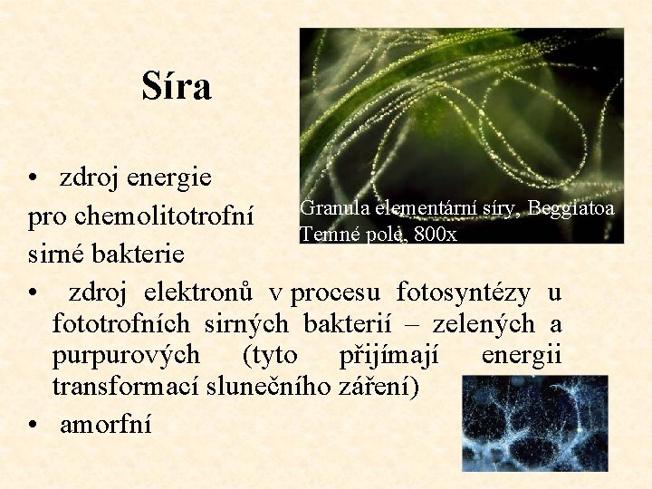 Síra • zdroj energie pro chemolitotrofní Granula elementární síry, Beggiatoa Temné pole, 800 x