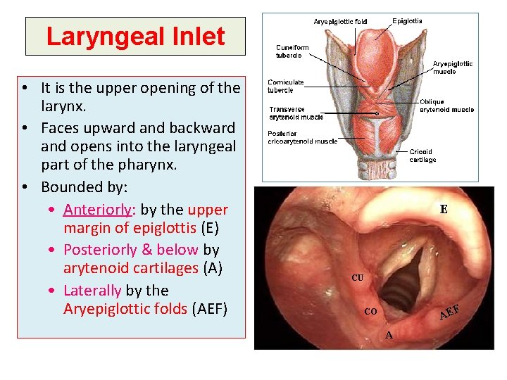 Laryngeal Inlet • It is the upper opening of the larynx. • Faces upward