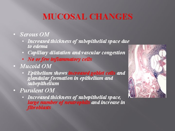 MUCOSAL CHANGES • Serous OM • Increased thickness of subepithelial space due to edema