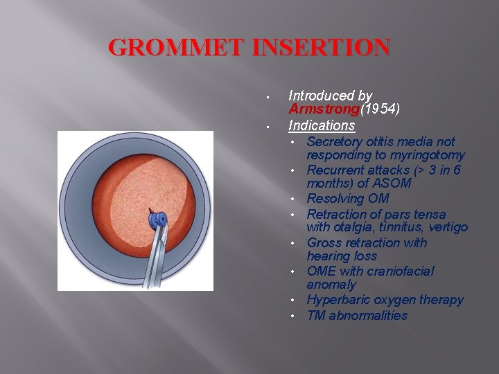 GROMMET INSERTION • • Introduced by Armstrong(1954) Indications • • Secretory otitis media not