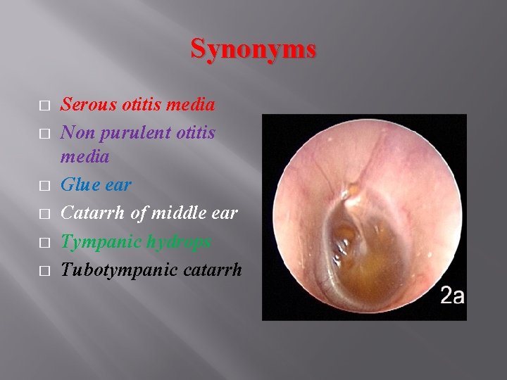 Synonyms � � � Serous otitis media Non purulent otitis media Glue ear Catarrh