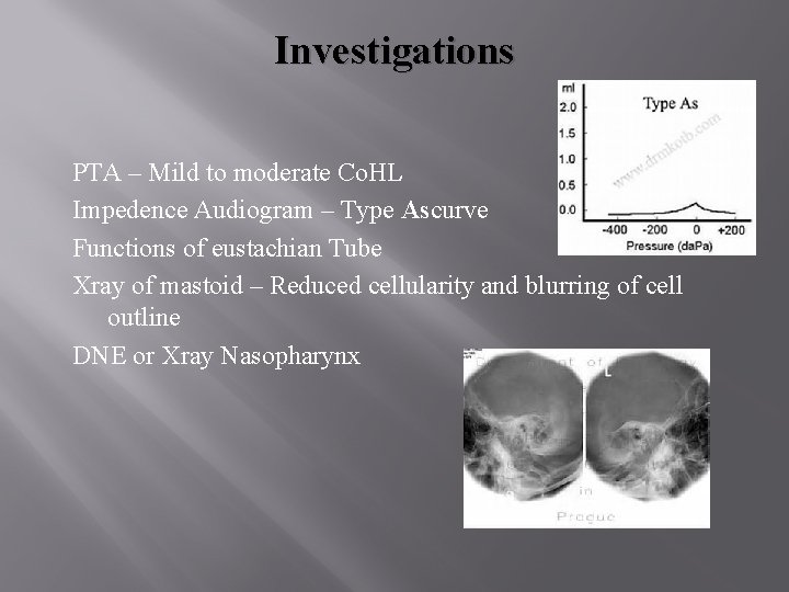 Investigations PTA – Mild to moderate Co. HL Impedence Audiogram – Type Ascurve Functions