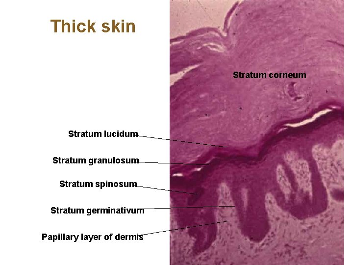 Thick skin Stratum corneum Stratum lucidum Stratum granulosum Stratum spinosum Stratum germinativum Papillary layer