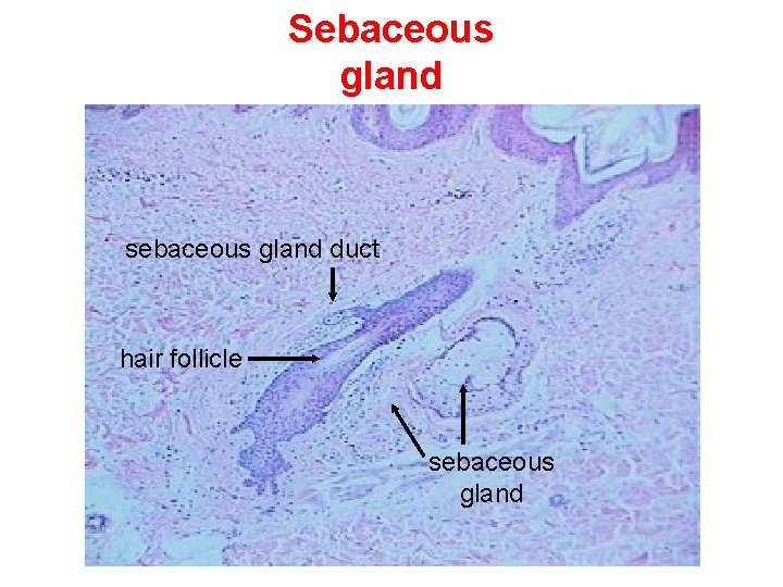 Sebaceous gland sebaceous gland duct hair follicle sebaceous gland 
