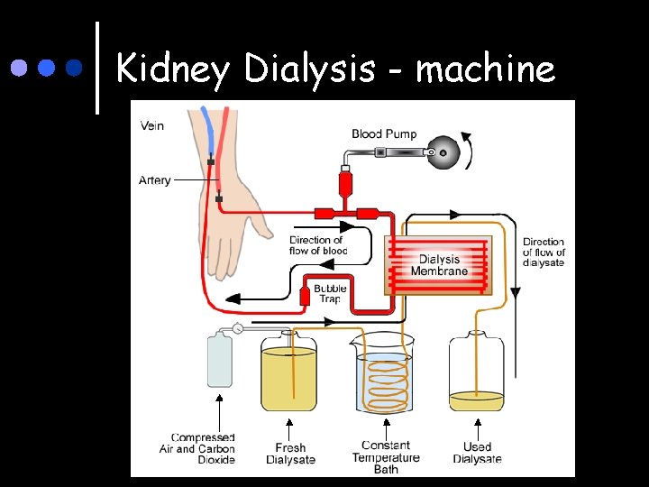 Kidney Dialysis - machine 