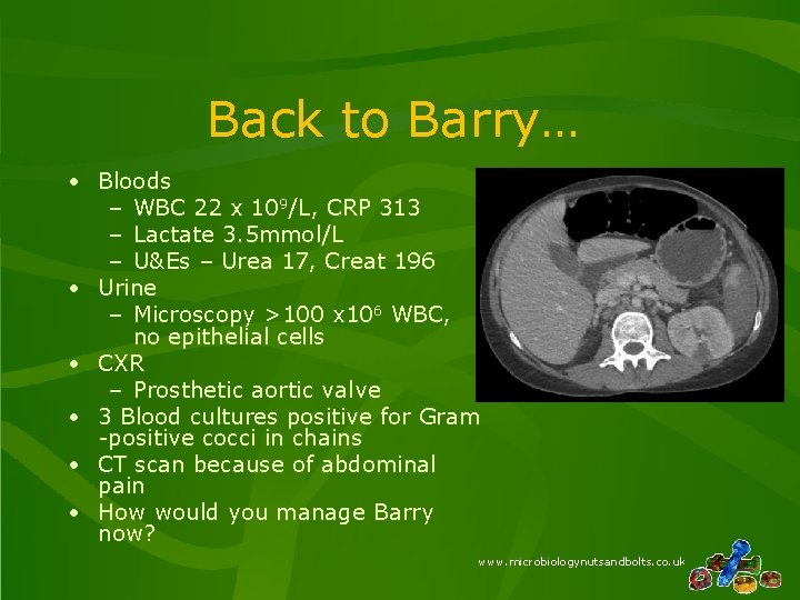 Back to Barry… • Bloods – WBC 22 x 109/L, CRP 313 – Lactate Back to Barry… • Bloods – WBC 22 x 109/L, CRP 313 – Lactate