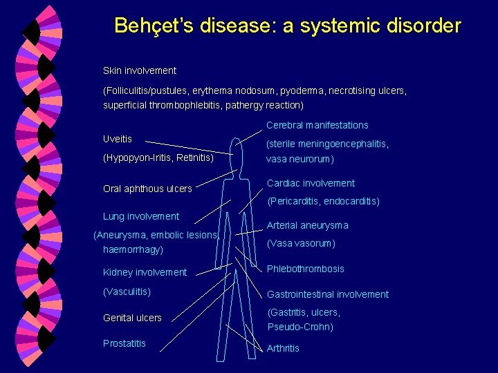 Behçet’s disease: a systemic disorder Skin involvement (Folliculitis/pustules, erythema nodosum, pyoderma, necrotising ulcers, superficial