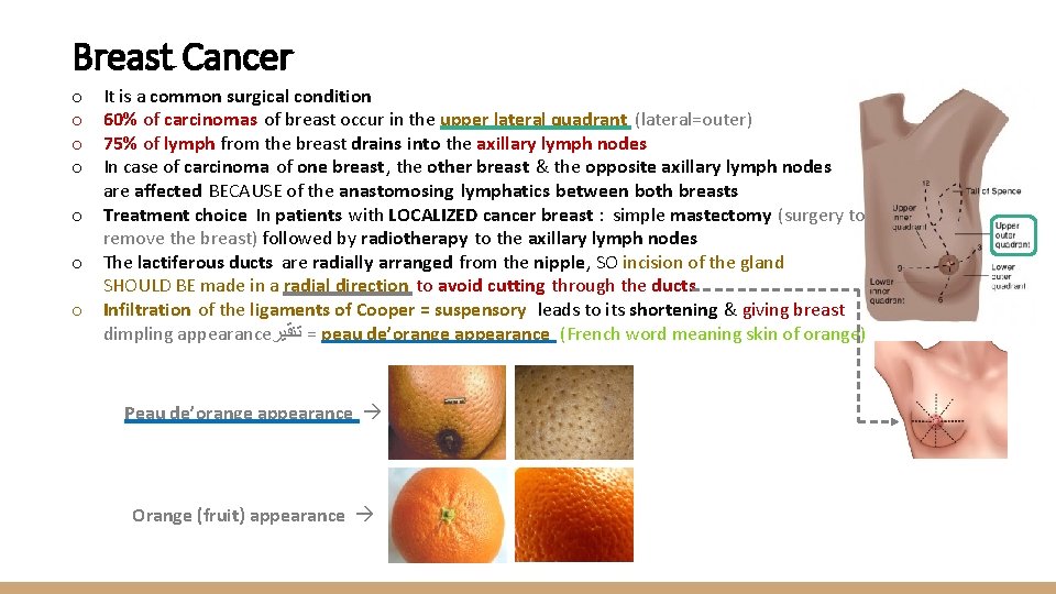 Breast Cancer It is a common surgical condition 60% of carcinomas of breast occur