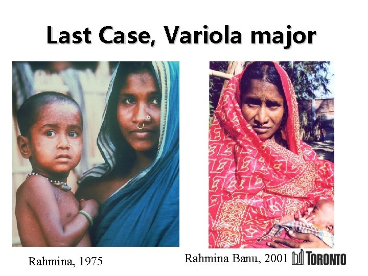 Last Case, Variola major Rahmina, 1975 Rahmina Banu, 2001 