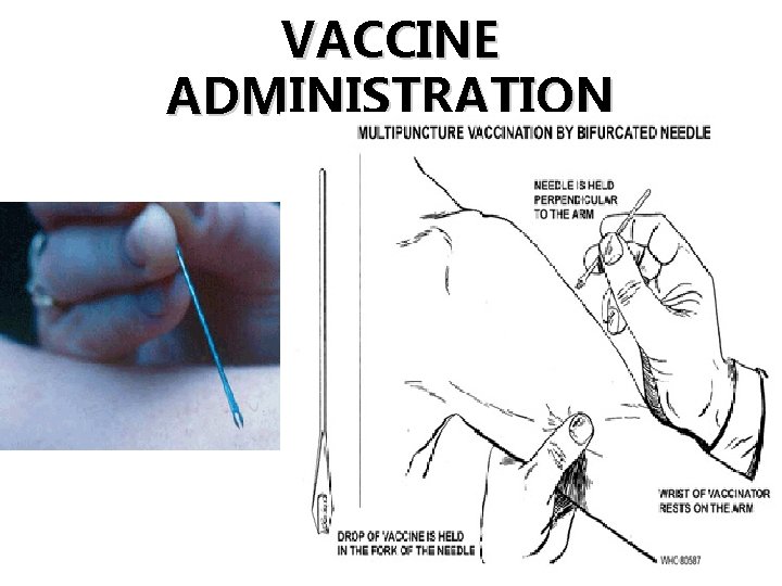 VACCINE ADMINISTRATION 