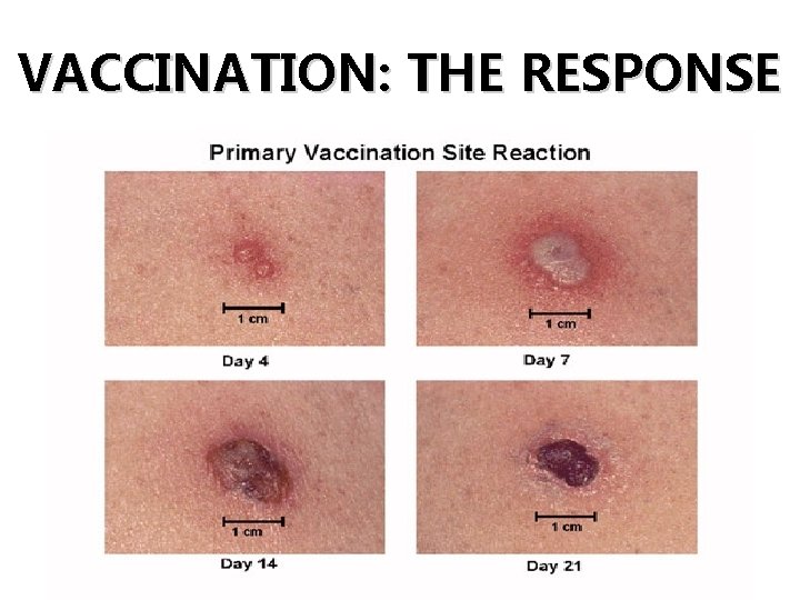 VACCINATION: THE RESPONSE 