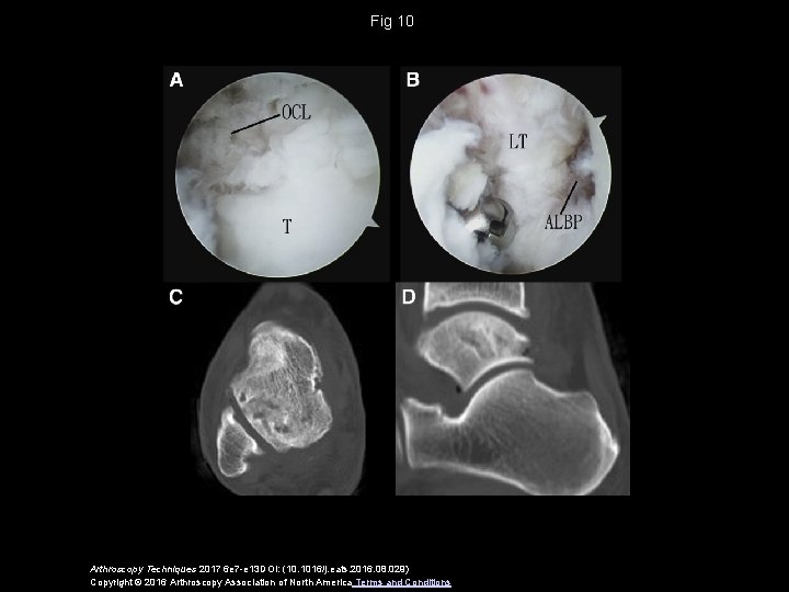 Fig 10 Arthroscopy Techniques 2017 6 e 7 -e 13 DOI: (10. 1016/j. eats.