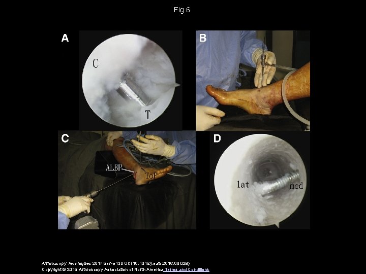 Fig 6 Arthroscopy Techniques 2017 6 e 7 -e 13 DOI: (10. 1016/j. eats.