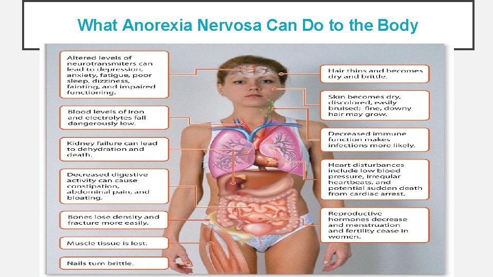 What Anorexia Nervosa Can Do to the Body 