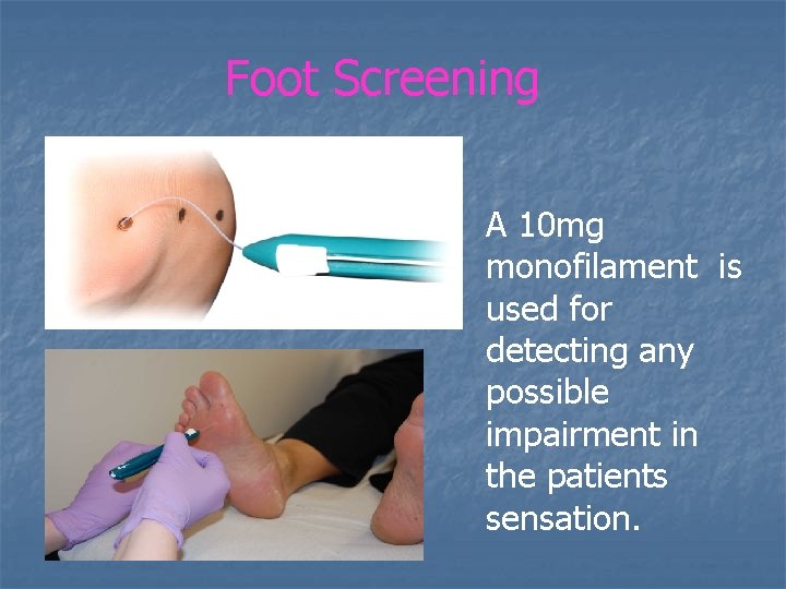 Foot Screening A 10 mg monofilament is used for detecting any possible impairment in