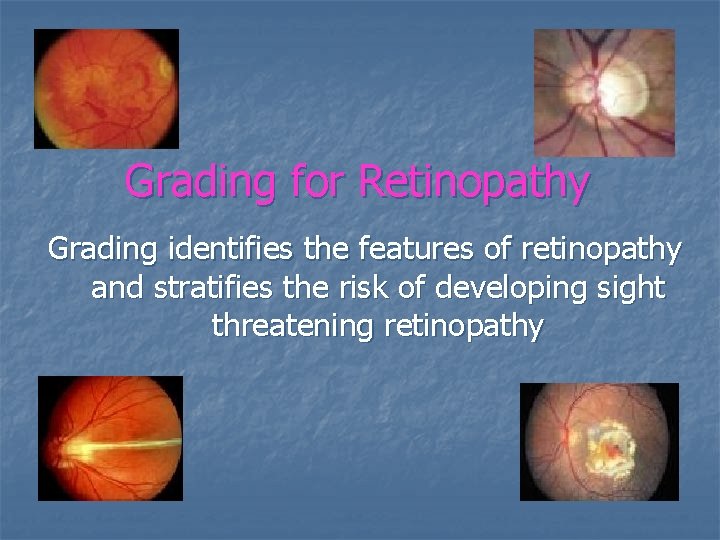 Grading for Retinopathy Grading identifies the features of retinopathy and stratifies the risk of