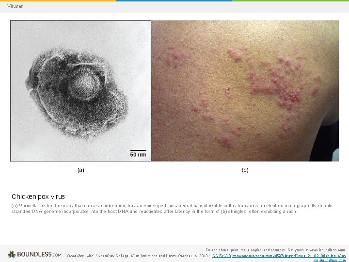 Viruses Chicken pox virus (a) Varicella-zoster, the virus that causes chickenpox, has an enveloped