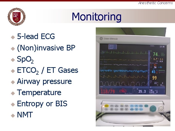 Anesthetic Concerns Monitoring 5 -lead ECG u (Non)invasive BP u Sp. O 2 u