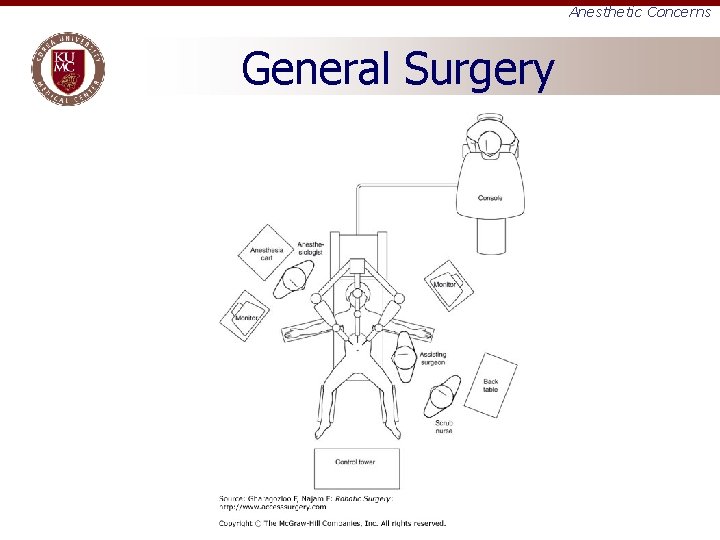 Anesthetic Concerns General Surgery 