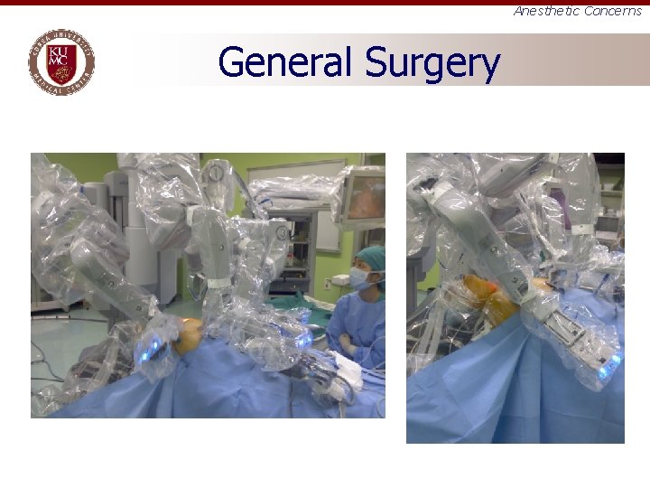 Anesthetic Concerns General Surgery 