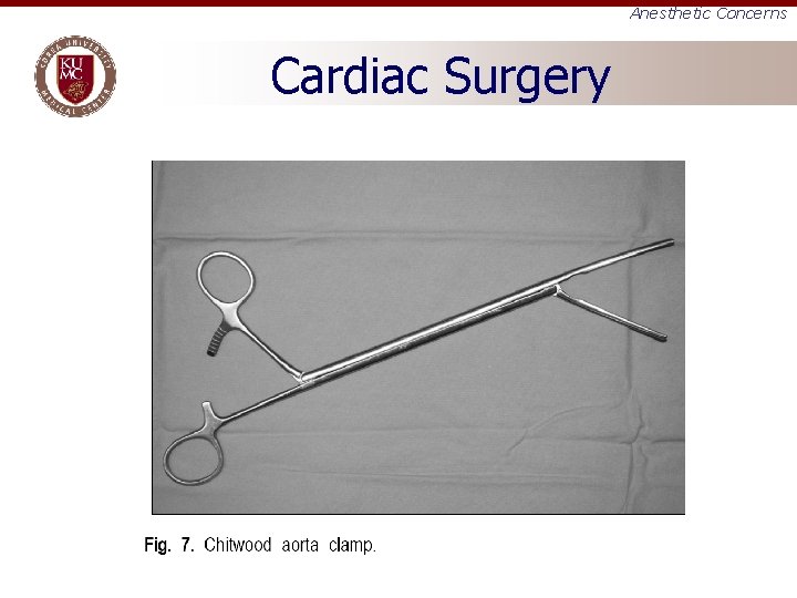 Anesthetic Concerns Cardiac Surgery 