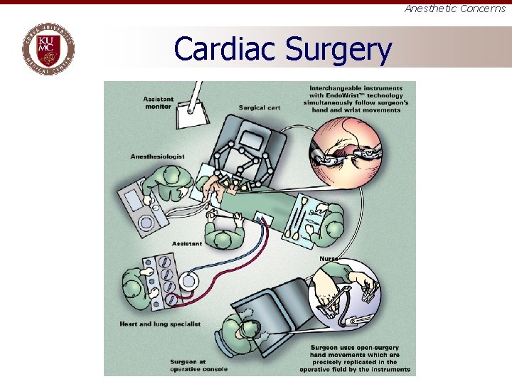 Anesthetic Concerns Cardiac Surgery 