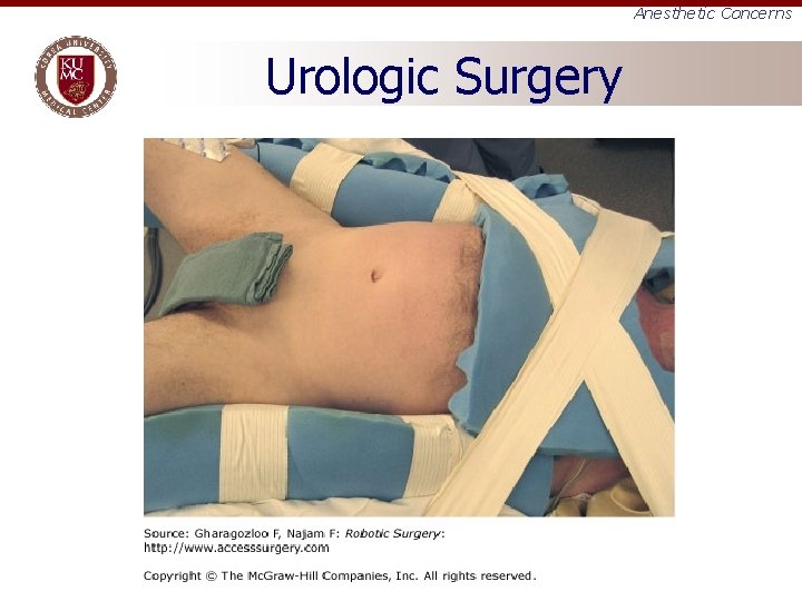 Anesthetic Concerns Urologic Surgery 