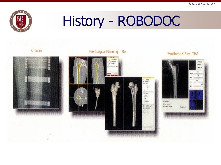 Introduction History - ROBODOC 