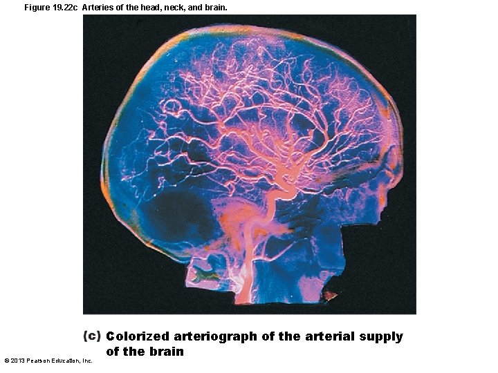 Figure 19. 22 c Arteries of the head, neck, and brain. © 2013 Pearson