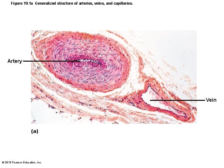 Figure 19. 1 a Generalized structure of arteries, veins, and capillaries. Artery Vein ©